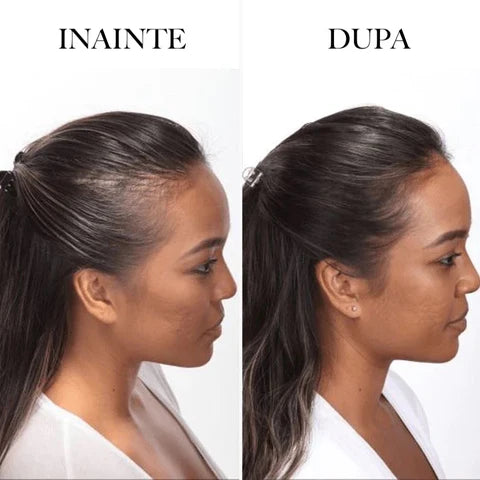 Pudră Hairline Naturală pentru Mascarea Golurilor